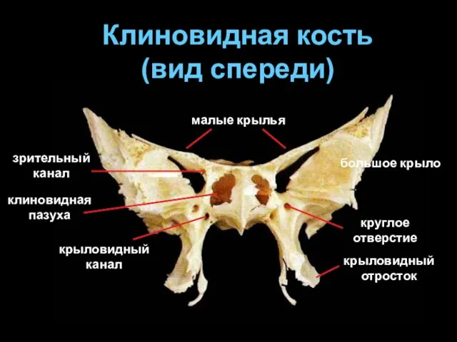 Клиновидная кость (вид спереди) большое крыло малые крылья круглое отверстие