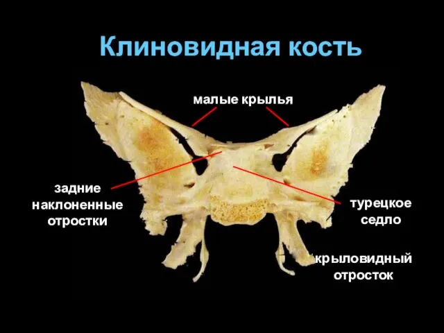 Клиновидная кость турецкое седло малые крылья задние наклоненные отростки крыловидный отросток
