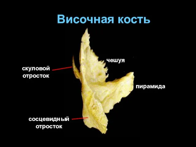 Височная кость скуловой отросток сосцевидный отросток пирамида чешуя