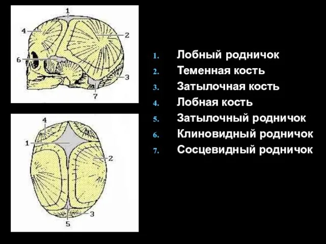 Лобный родничок Теменная кость Затылочная кость Лобная кость Затылочный родничок Клиновидный родничок Сосцевидный родничок