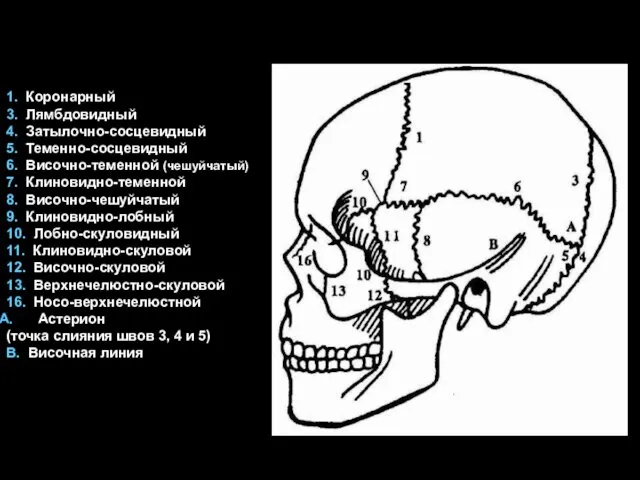 1. Коронарный 3. Лямбдовидный 4. Затылочно-сосцевидный 5. Теменно-сосцевидный 6. Височно-теменной