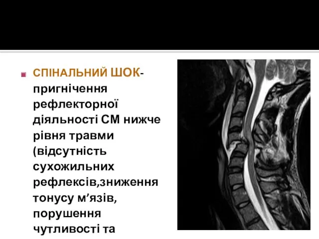 СПІНАЛЬНИЙ ШОК-пригнічення рефлекторної діяльності СМ нижче рівня травми(відсутність сухожильних рефлексів,зниження тонусу м’язів,порушення чутливості