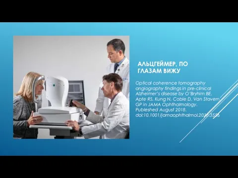 АЛЬЦГЕЙМЕР, ПО ГЛАЗАМ ВИЖУ Optical coherence tomography angiography findings in