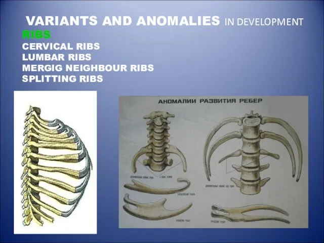 VARIANTS AND ANOMALIES IN DEVELOPMENT RIBS CERVICAL RIBS LUMBAR RIBS MERGIG NEIGHBOUR RIBS SPLITTING RIBS