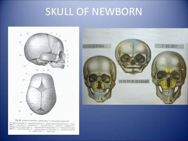 SKULL OF NEWBORN