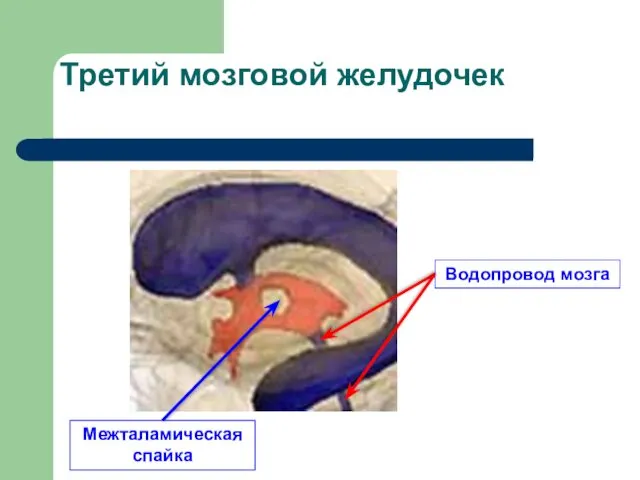 Третий мозговой желудочек Межталамическая спайка Водопровод мозга