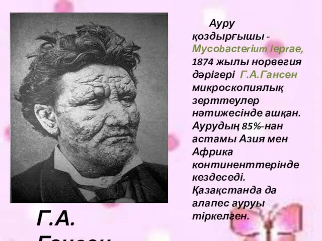 Ауру қоздырғышы -Мусоbасtеrіum lерrае, 1874 жылы норвегия дәрігері Г.А.Гансен микроскопиялық