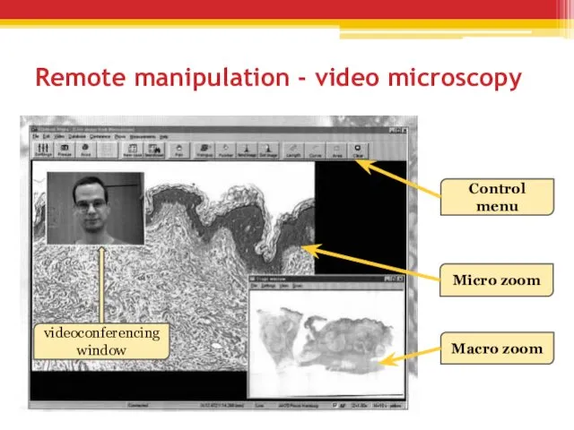 Remote manipulation - video microscopy videoconferencing window Control menu Micro zoom Macro zoom