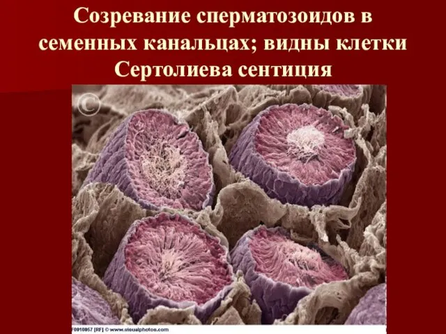 Созревание сперматозоидов в семенных канальцах; видны клетки Сертолиева сентиция