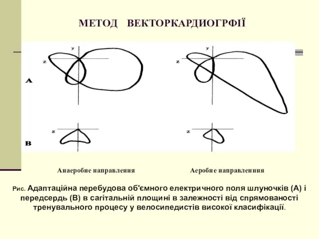 МЕТОД ВЕКТОРКАРДИОГРФІЇ Рис. Адаптаційна перебудова об'ємного електричного поля шлуночків (А)