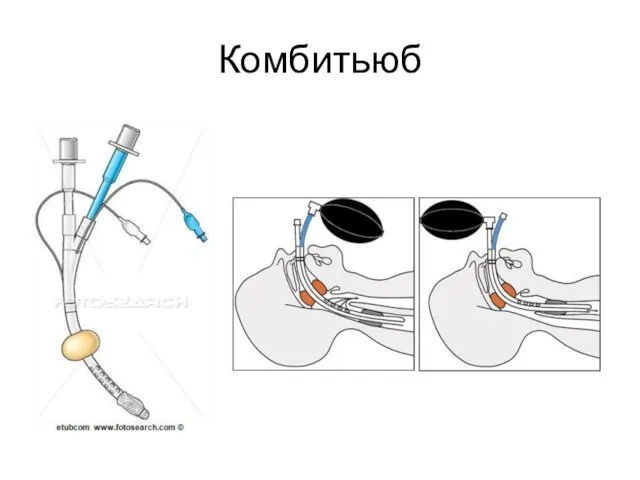 Комбитьюб