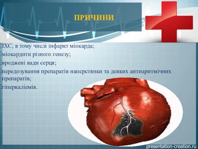 ПРИЧИНИ ІХС, в тому числі інфаркт міокарда; міокардити різного генезу; вроджені вади серця;