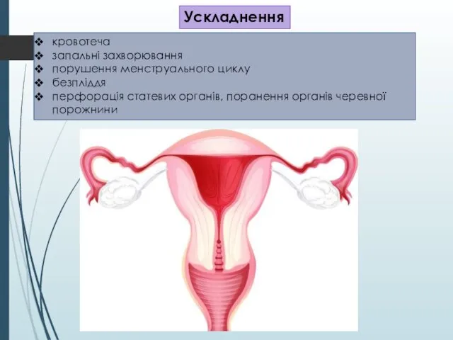 Ускладнення кровотеча запальні захворювання порушення менструального циклу безпліддя перфорація статевих органів, поранення органів черевної порожнини