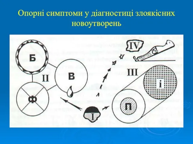 Опорні симптоми у діагностиці злоякісних новоутворень