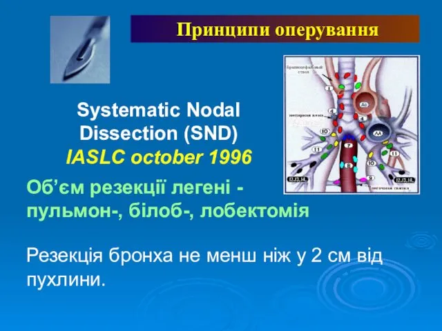 Systematic Nodal Dissection (SND) IASLC october 1996 Принципи оперування Об’єм