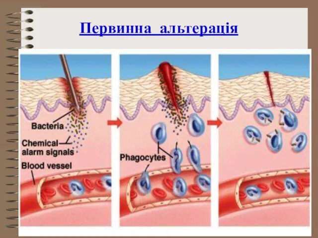 Первинна альтерація