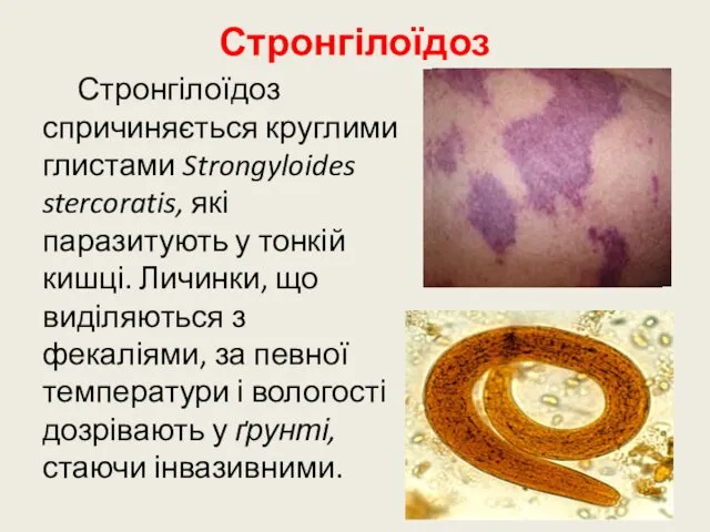 Стронгілоїдоз Стронгілоїдоз спричиняється круглими глистами Strongyloides stercoratis, які паразитують у