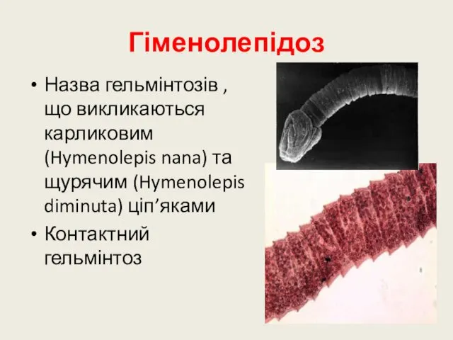 Гіменолепідоз Назва гельмінтозів , що викликаються карликовим (Hymenolepis nana) та щурячим (Hymenolepis diminuta) ціп’яками Контактний гельмінтоз