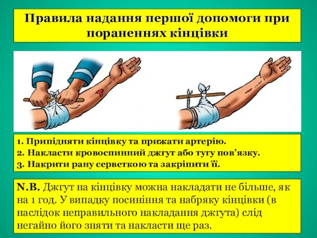 Правила надання першої допомоги при пораненнях кінцівки 1. Припідняти кінцівку