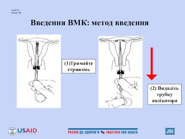 Слайд 14 Модуль №4 Введення ВМК: метод введення (2) Видаліть трубку аплікатора (1)Тримайте стрижень