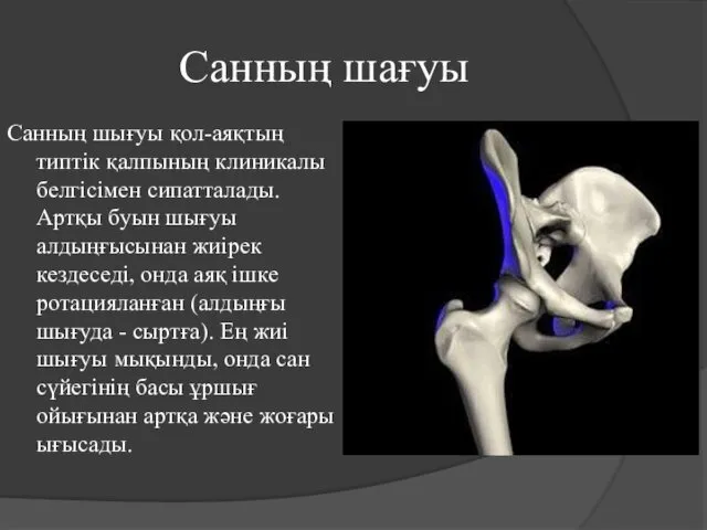 Санның шағуы Санның шығуы қол-аяқтың типтік қалпының клиникалы белгісімен сипатталады. Артқы буын шығуы