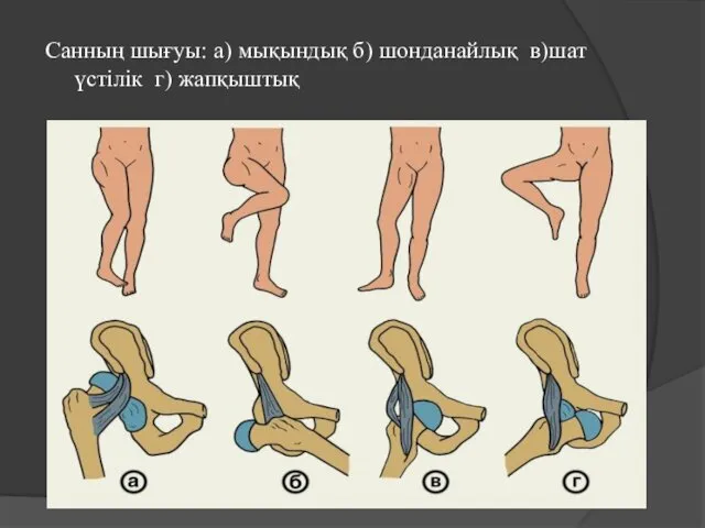 Санның шығуы: а) мықындық б) шонданайлық в)шат үстілік г) жапқыштық