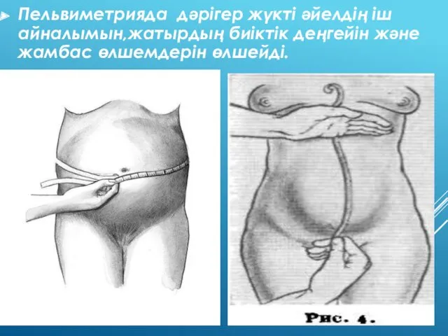 Пельвиметрияда дәрігер жүкті әйелдің іш айналымын,жатырдың биіктік деңгейін және жамбас өлшемдерін өлшейді.