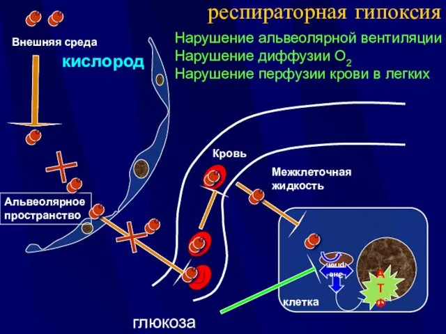 Внешняя среда Межклеточная жидкость респираторная гипоксия Нарушение альвеолярной вентиляции Нарушение