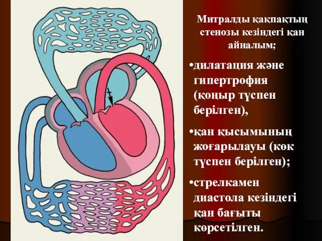 Митралды қақпақтың стенозы кезіндегі қан айналым; дилатация және гипертрофия (қоңыр