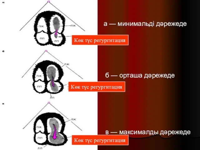 а — минимальді дәрежеде б — орташа дәрежеде в —