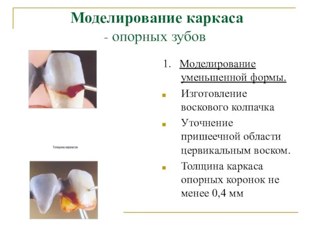 Моделирование каркаса - опорных зубов 1. Моделирование уменьшенной формы. Изготовление