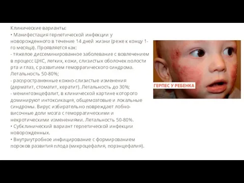 Клинические варианты: • Манифестация герпетической инфекции у новорожденного в течение