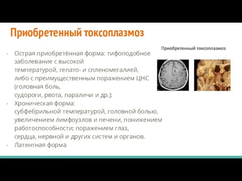 Приобретенный токсоплазмоз Острая приобретённая форма: тифоподобное заболевание с высокой температурой,