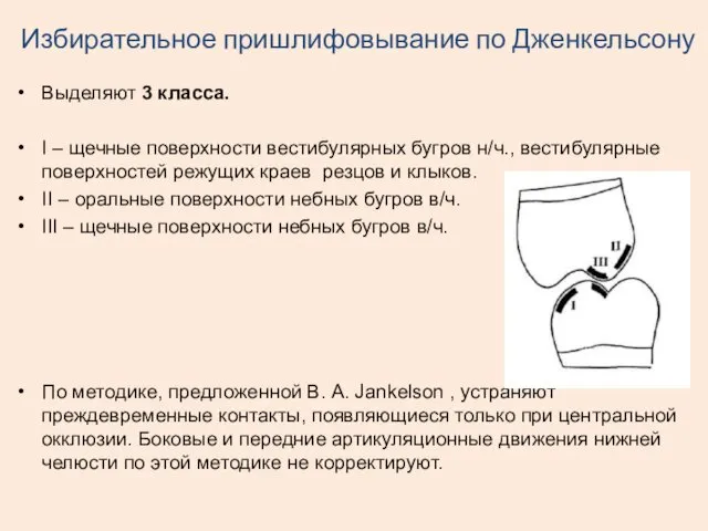 Избирательное пришлифовывание по Дженкельсону Выделяют 3 класса. Ι – щечные