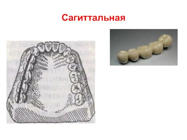 Сагиттальная