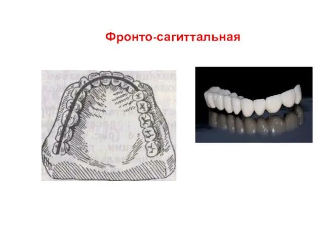 Фронто-сагиттальная