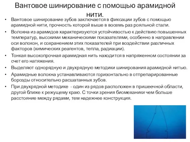 Вантовое шинирование с помощью арамидной нити. Вантовое шинирование зубов заключается