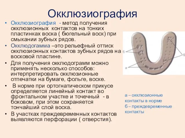 Окклюзиография Окклюзиография - метод получения окклюзионных контактов на тонких пластинках