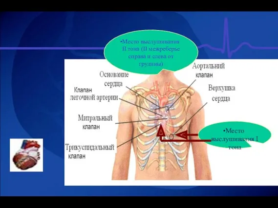 Место выслушивания ІІ тона (ІІ межреберье справа и слева от грудины) Место выслушивания І тона