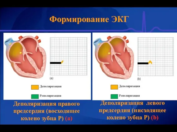 Формирование ЭКГ Деполяризация правого предсердия (восходящее колено зубца Р) (а)