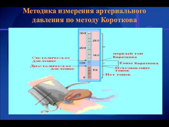 Методика измерения артериального давления по методу Короткова