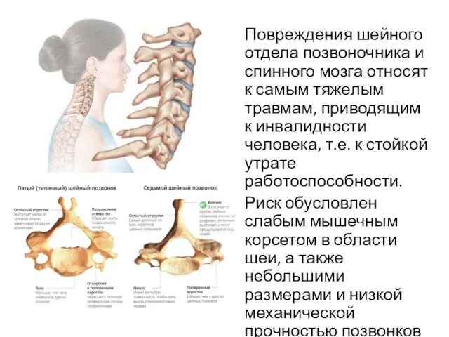 Повреждения шейного отдела позвоночника и спинного мозга относят к самым