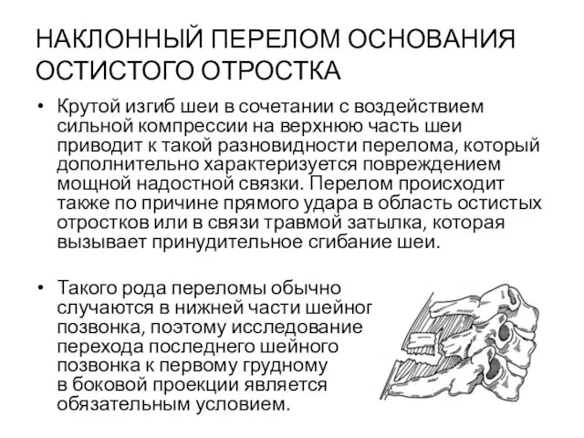 НАКЛОННЫЙ ПЕРЕЛОМ ОСНОВАНИЯ ОСТИСТОГО ОТРОСТКА Крутой изгиб шеи в сочетании