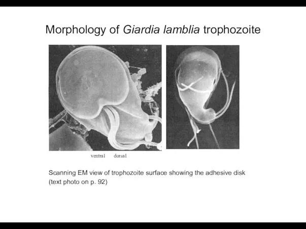 Morphology of Giardia lamblia trophozoite ventral dorsal Scanning EM view