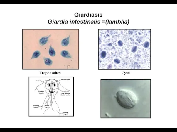 Giardiasis Giardia intestinalis =(lamblia) Trophozoites Cysts