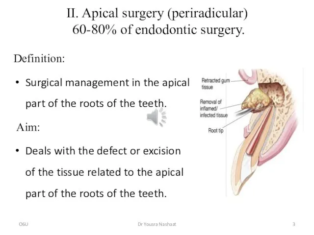 II. Apical surgery (periradicular) 60-80% of endodontic surgery. Definition: Surgical