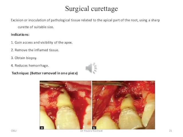 Surgical curettage Excision or inoculation of pathological tissue related to