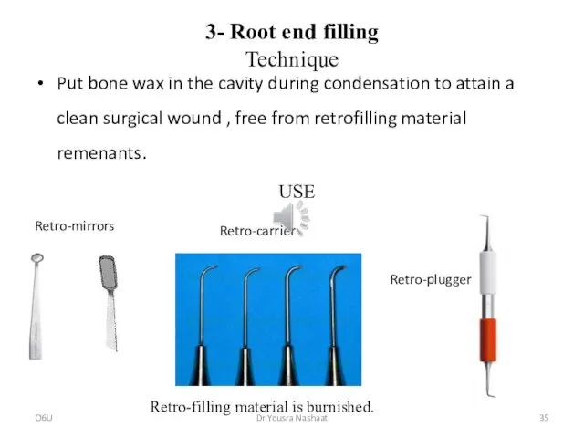 3- Root end filling Technique Put bone wax in the