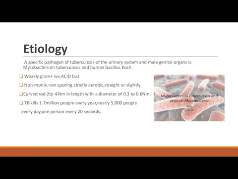 Etiology A specific pathogen of tuberculosis of the urinary system