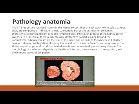 Pathology anatomia Initial TB lesions are localized mainly in the